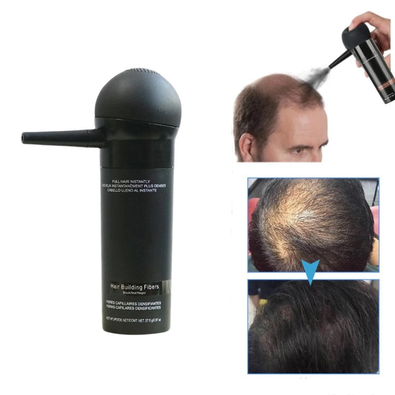 Keratin Hair Building Fibres (27.5g) | Instant Hair Loss Concealer Powder | Natural Thickening Spray